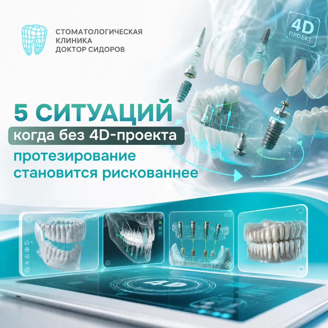 📊 5 ситуаций, когда без 4D-проекта протезирование становится рискованнее