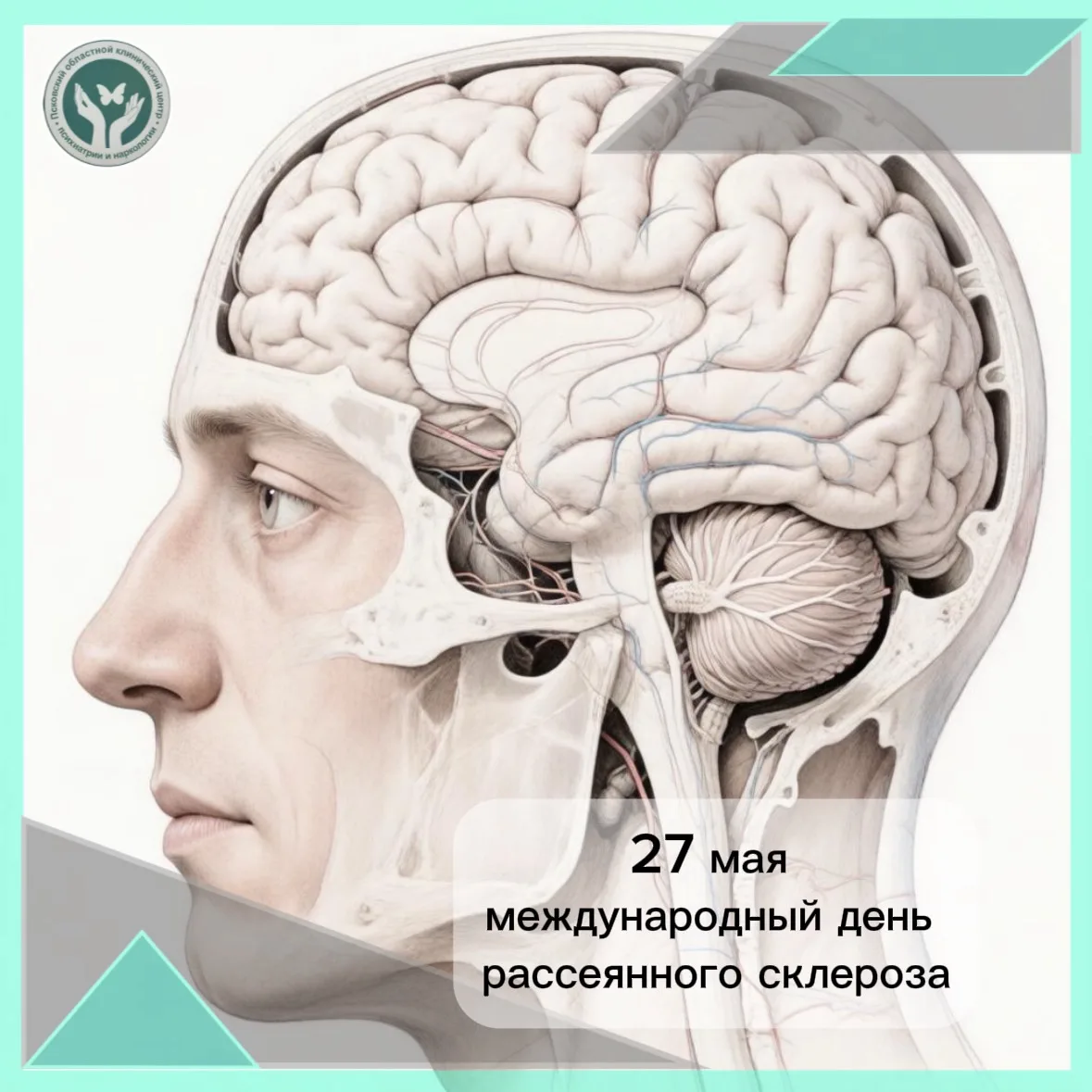 Психологическая поддержка при рассеянном склерозе