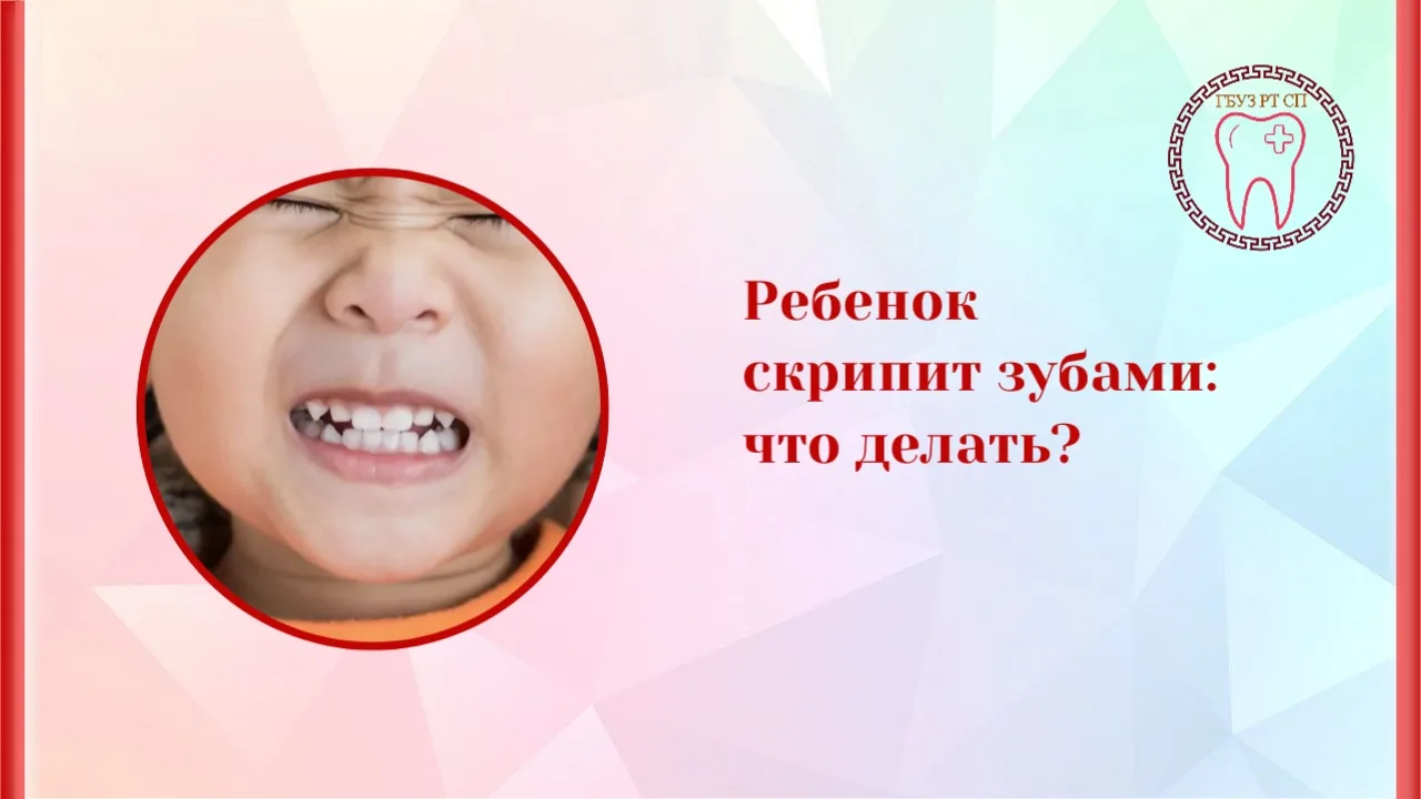 Бруксизм (непроизвольный скрежет зубами) у детей — распространённое явление, которое часто связано с