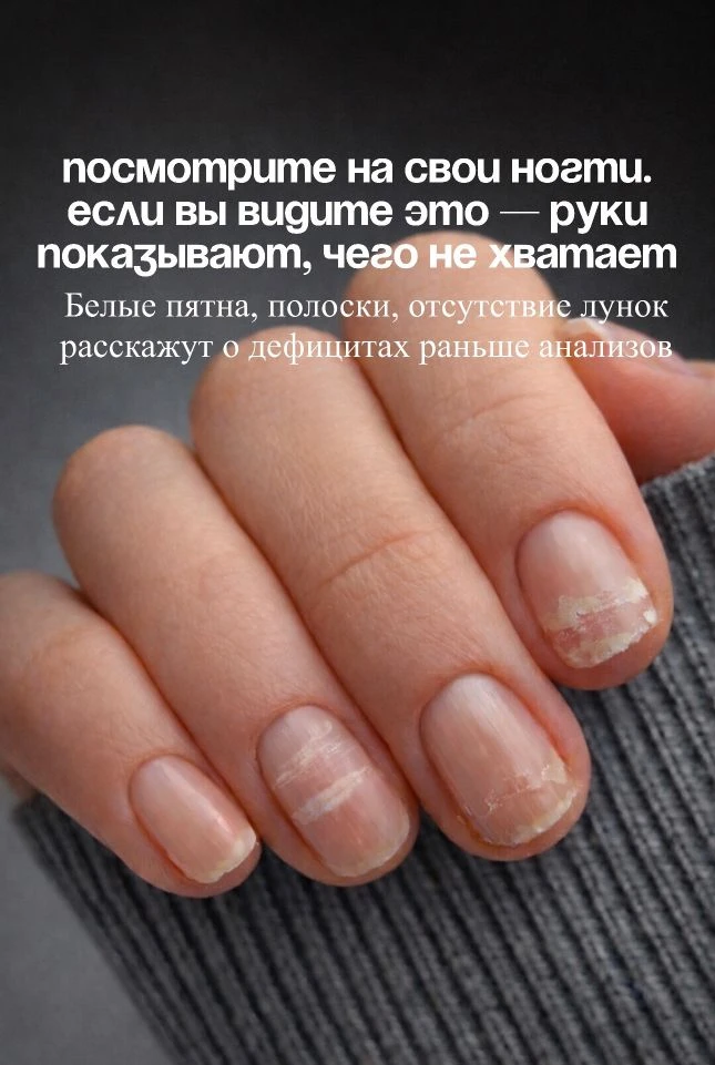 Как определить свои дефициты по ногтям?