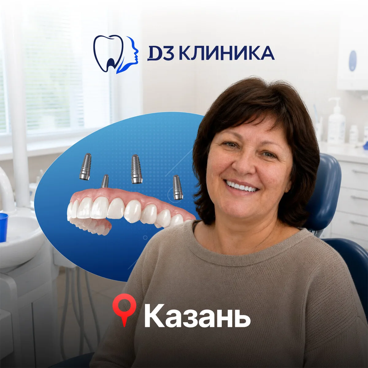 Несъёмное протезирование всей челюсти на 4-х имплантах