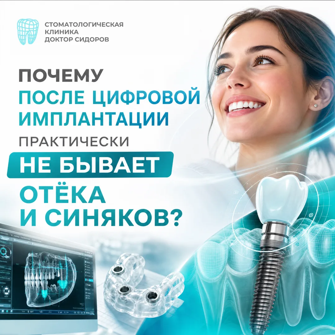 ❓Почему после цифровой имплантации практически не бывает отёка и синяков?