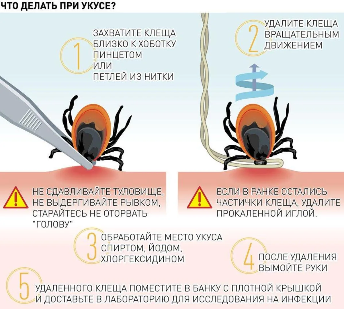 Алгоритм действий при укусе клеща

1. Удаление клеща

- Удаляйте клеща как можно быстрее. Лучше всег