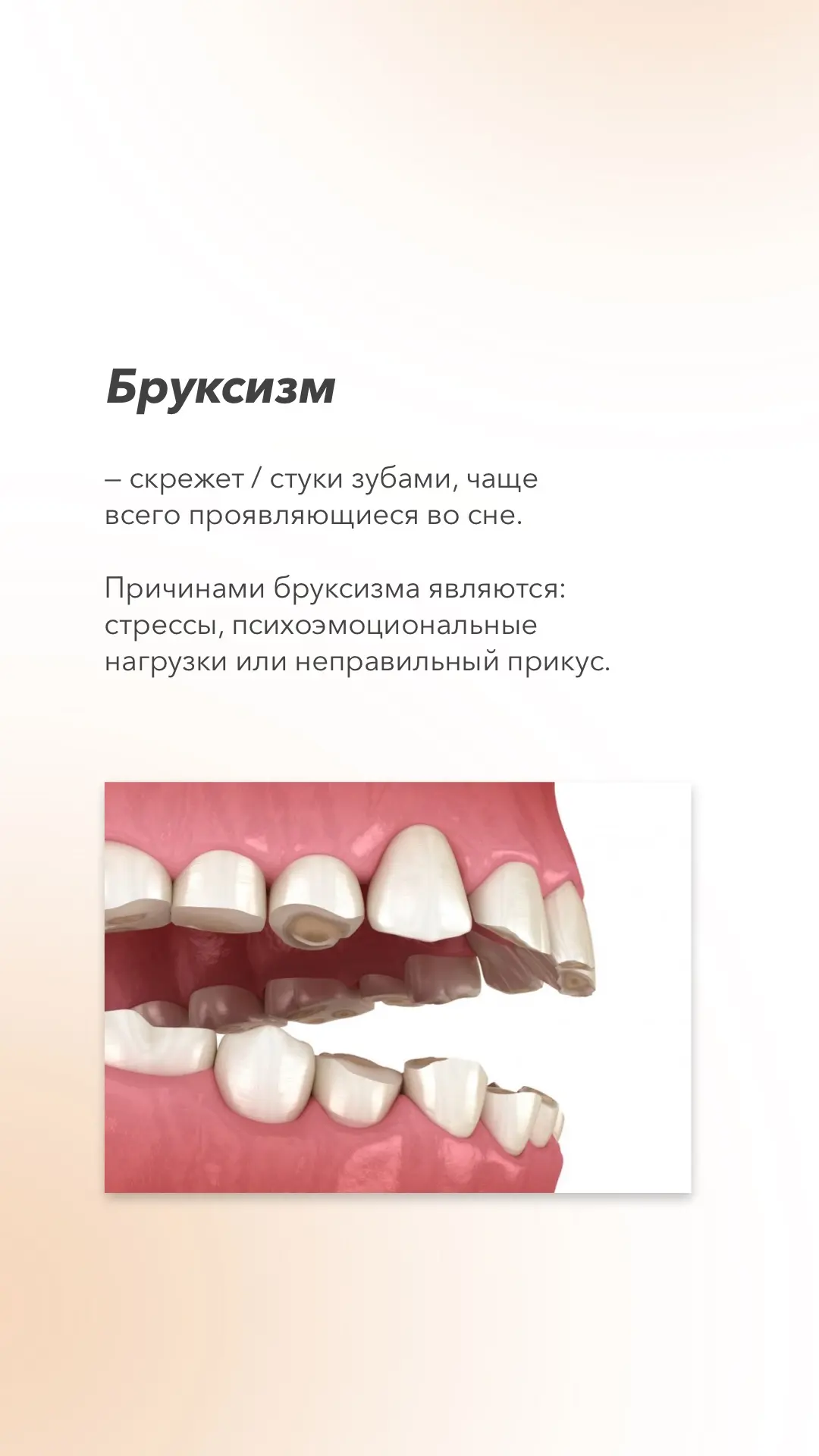 Правильный ответ - бруксизм🦷