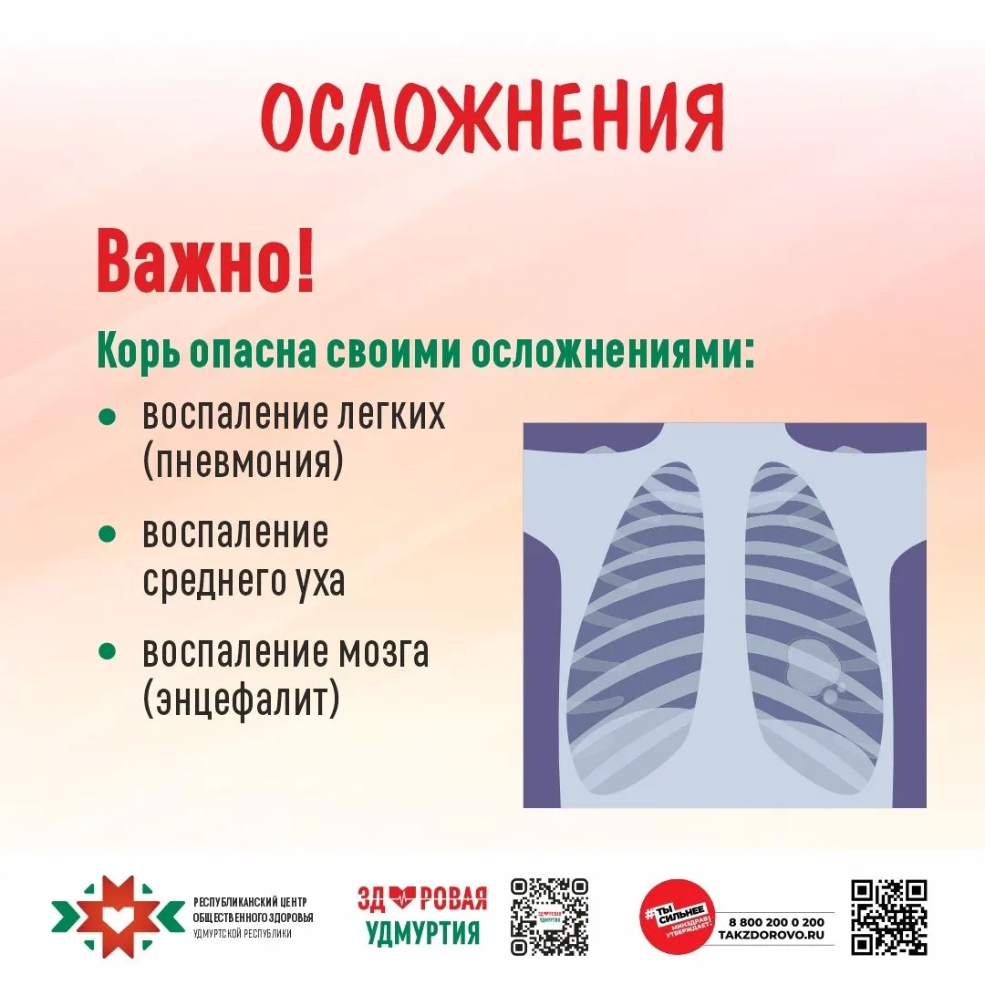 Когда-то корь считалась типично «детской болезнью», но сегодня под угрозой заражения на...