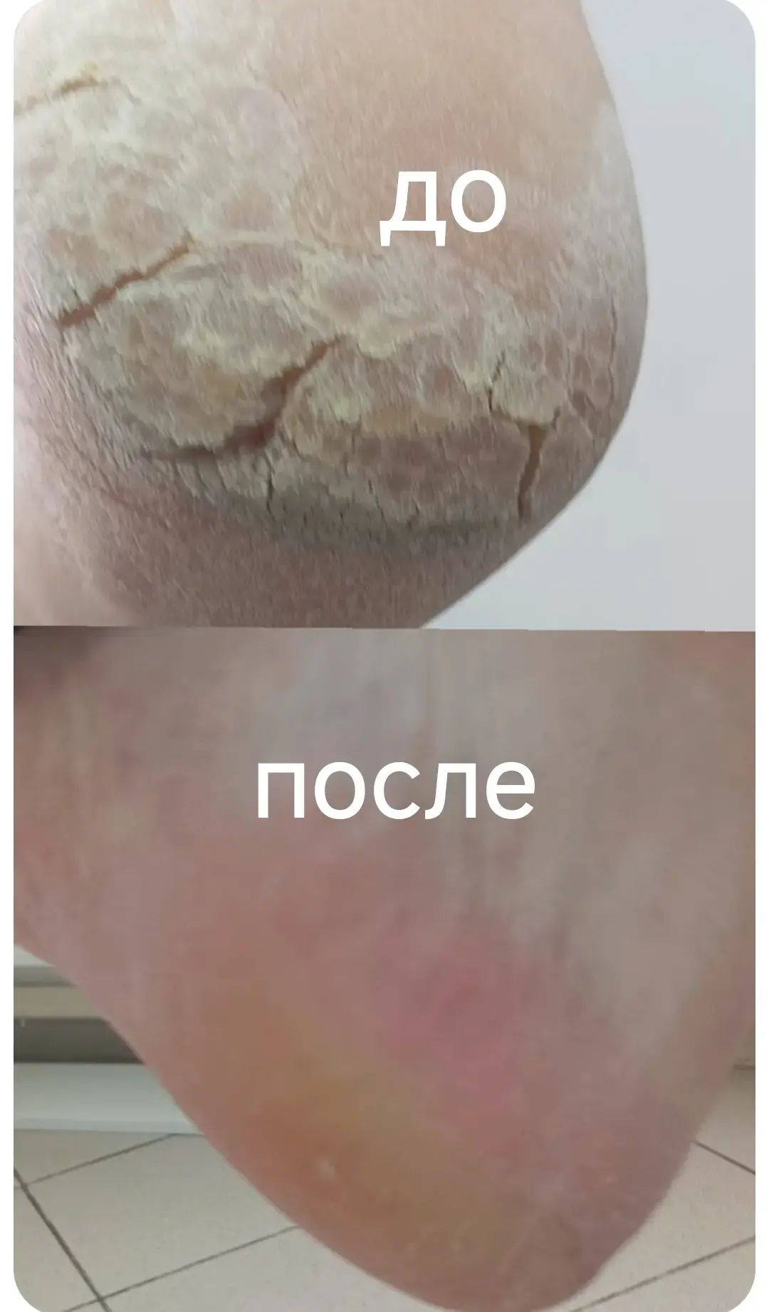 Социальный контракт помог Татьяне Пихур вернуться к любимой работе 👩‍⚕️💅  #соцконтракт_в_действии В 