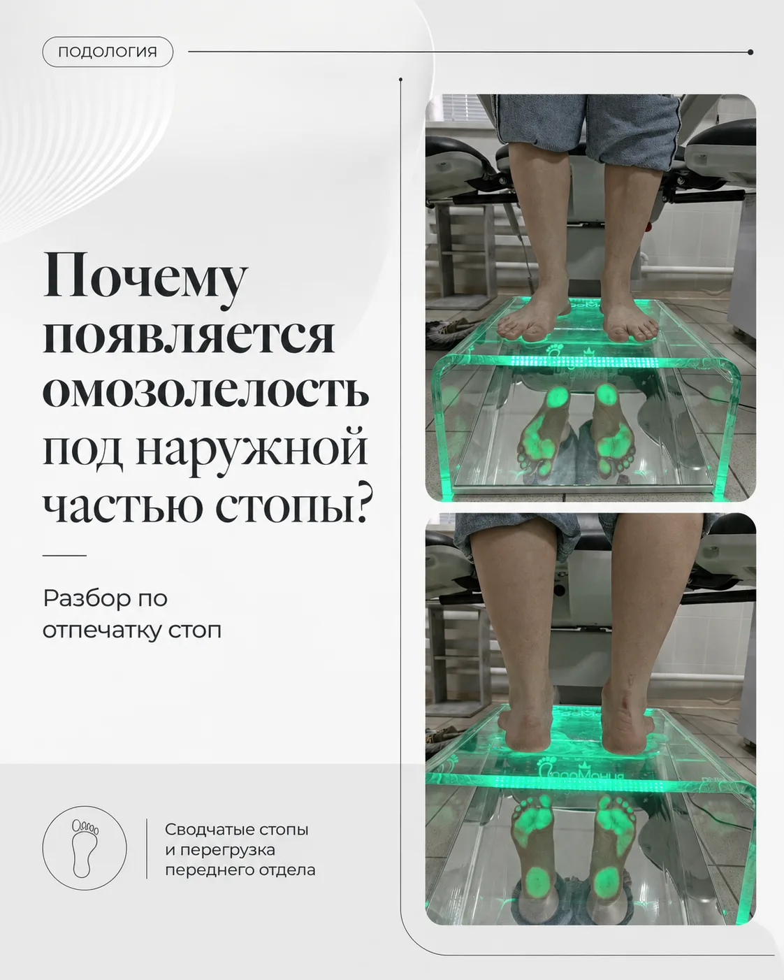 Иногда человек приходит с жалобой на плотную, быстро нарастающую кожу в одном и том же месте (омозол
