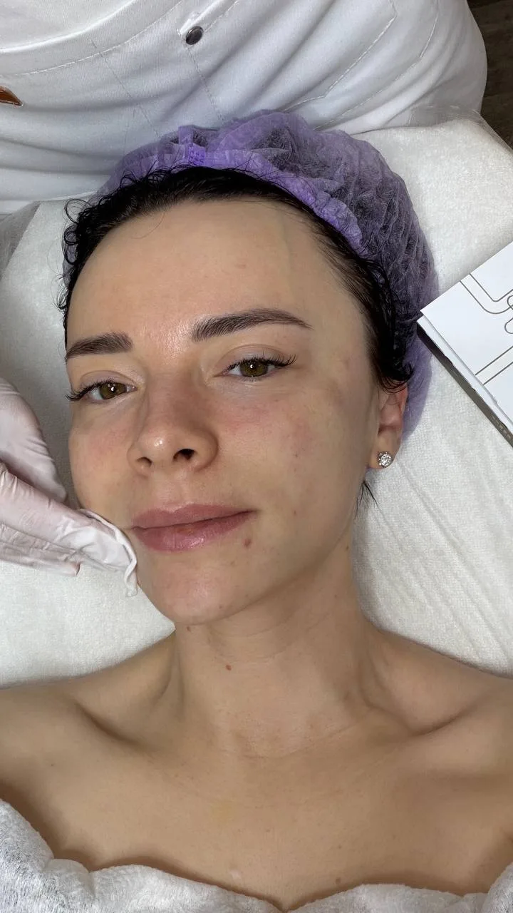 Это было больно..