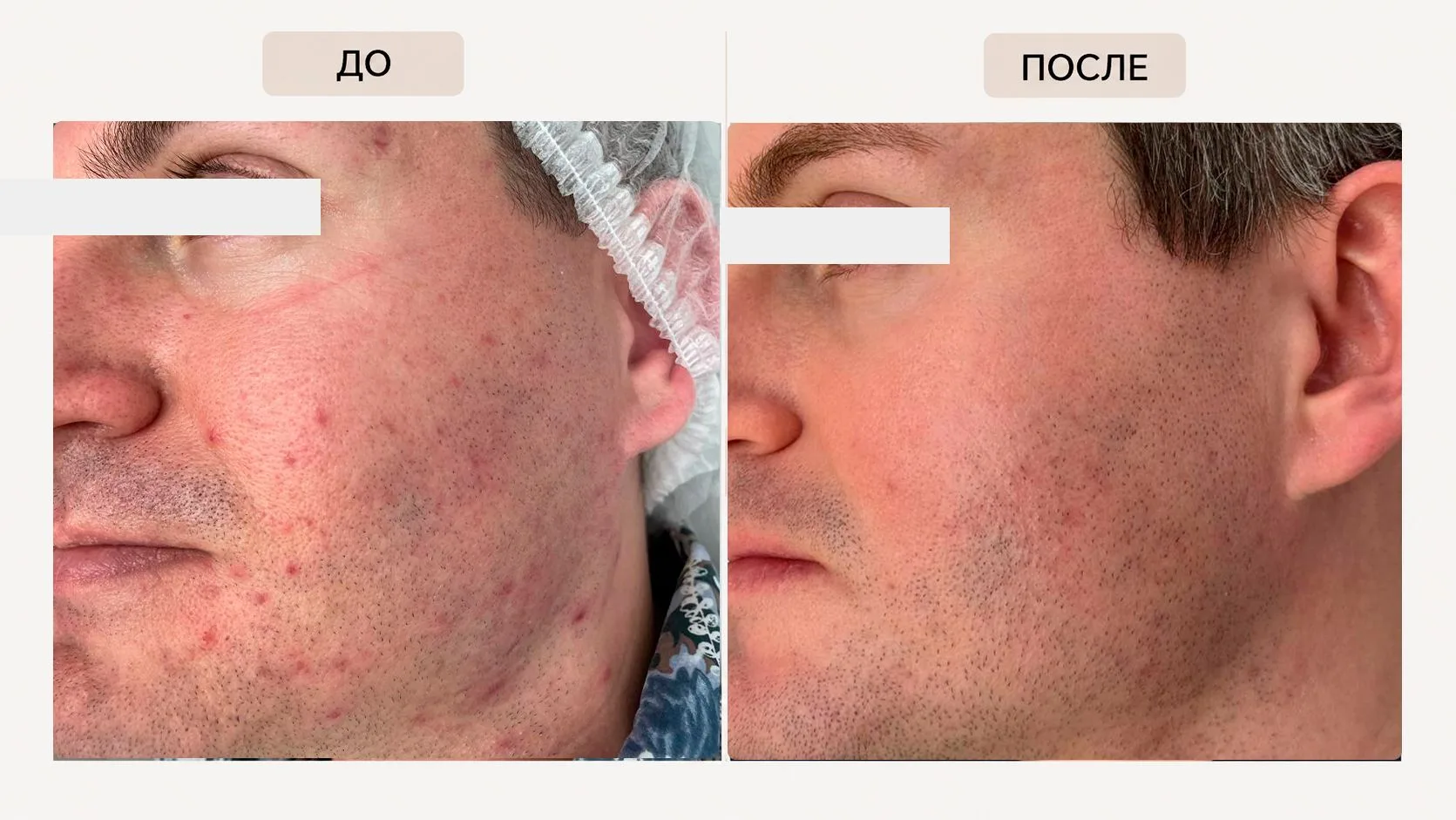 Мужская кожа тоже нуждается в профессиональной заботе