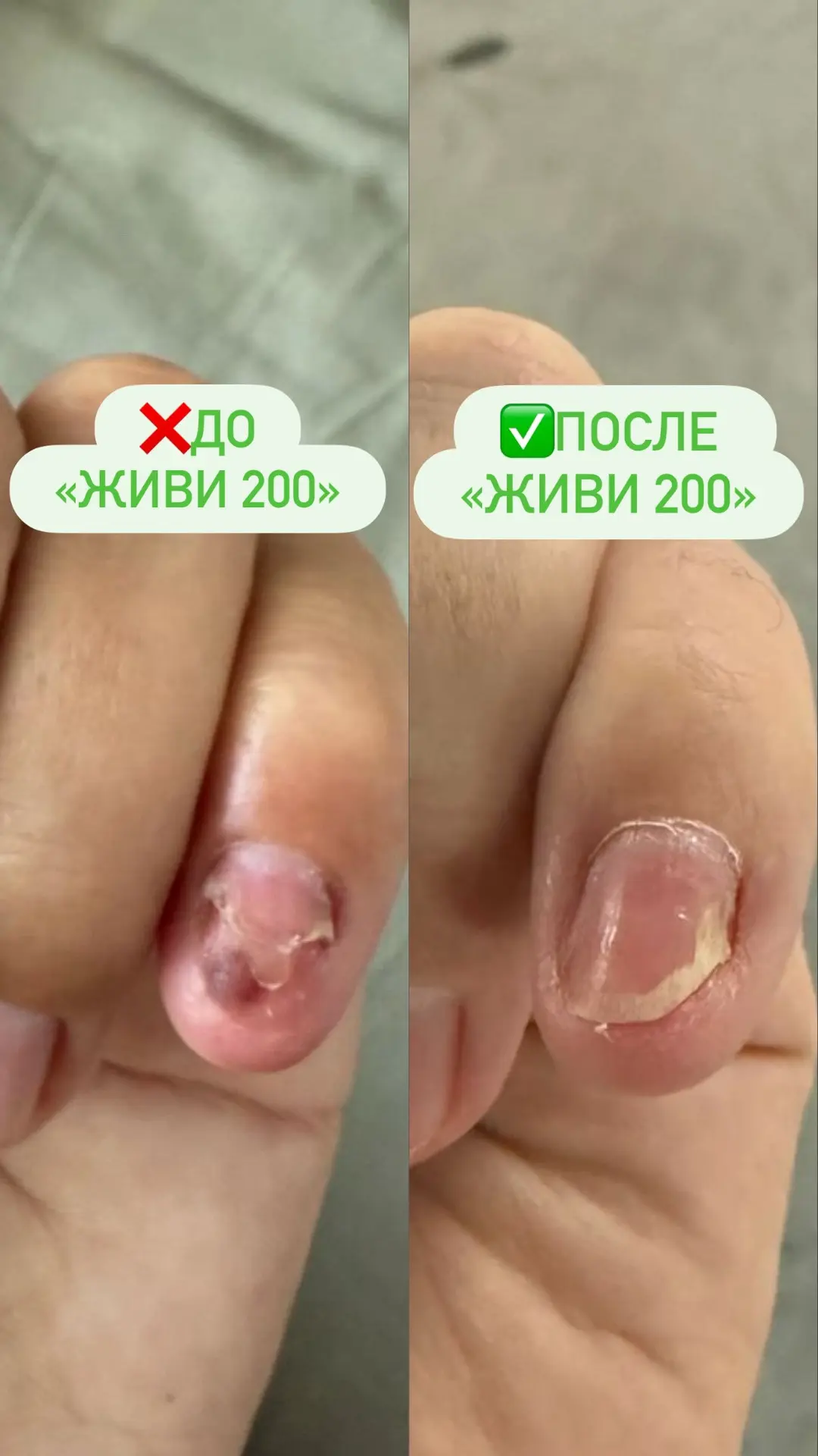 Когда я чувствую вялость, дискомфорт в кишечнике и тяжесть – это для меня сразу сигнал,...