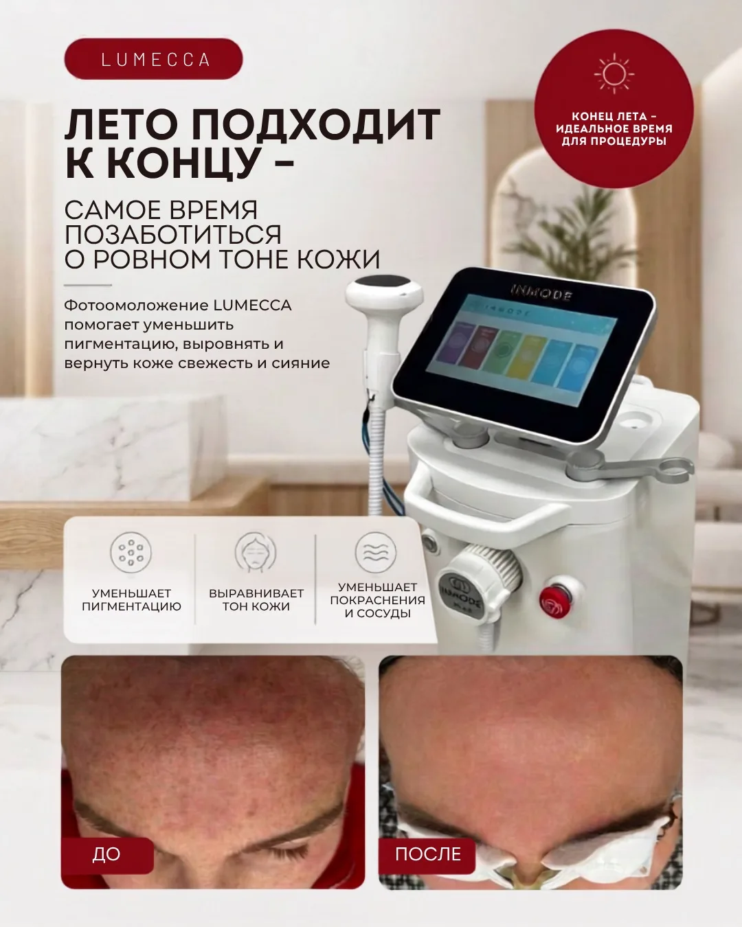 Лето подходит к концу — самое время вспомнить о пигментации