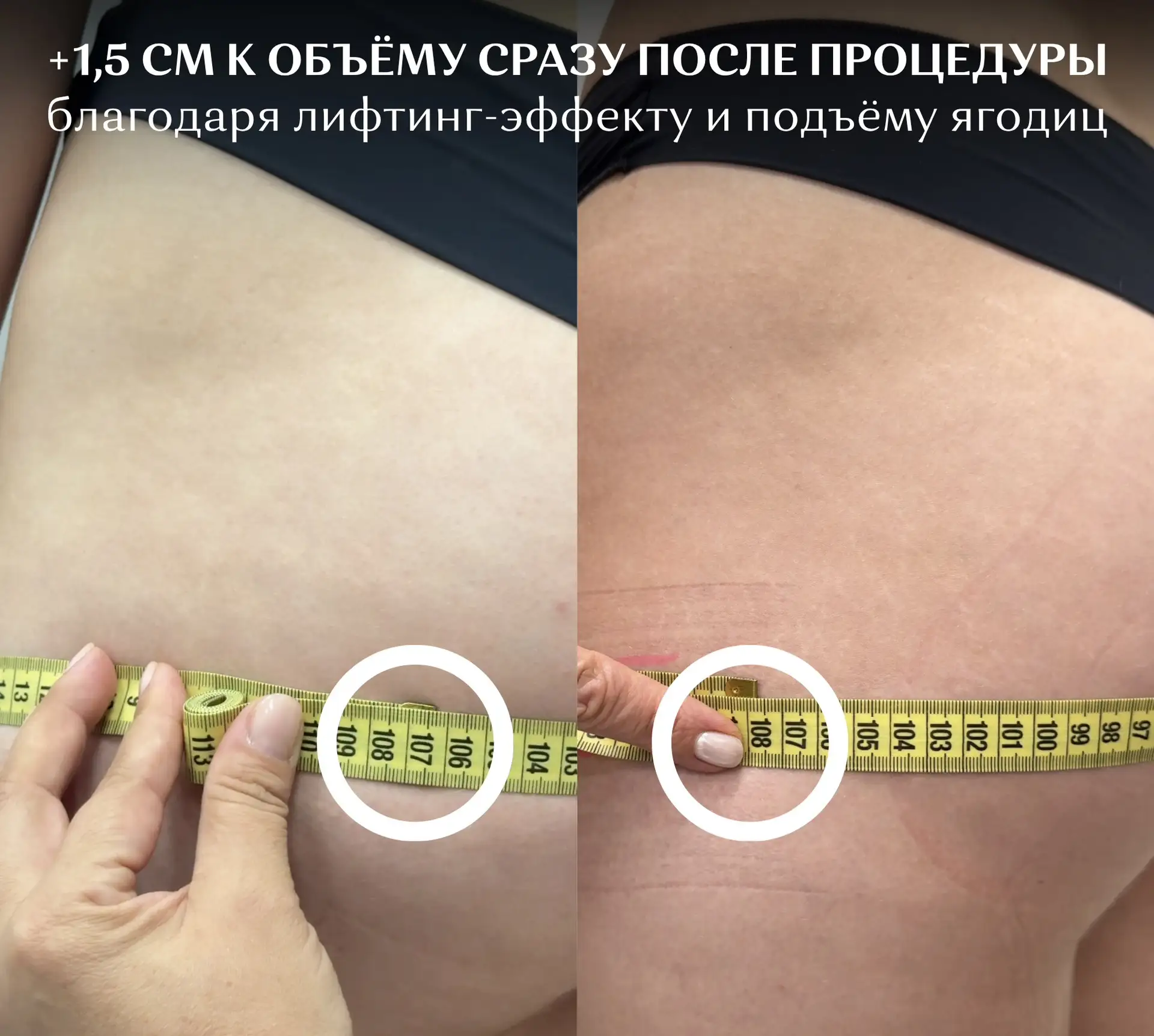 ПЕРВЫЕ РЕЗУЛЬТАТЫ ПРОЦЕДУРЫ BODYLAB® В ПОСОЛЬСТВЕ КРАСОТЫ 🔥