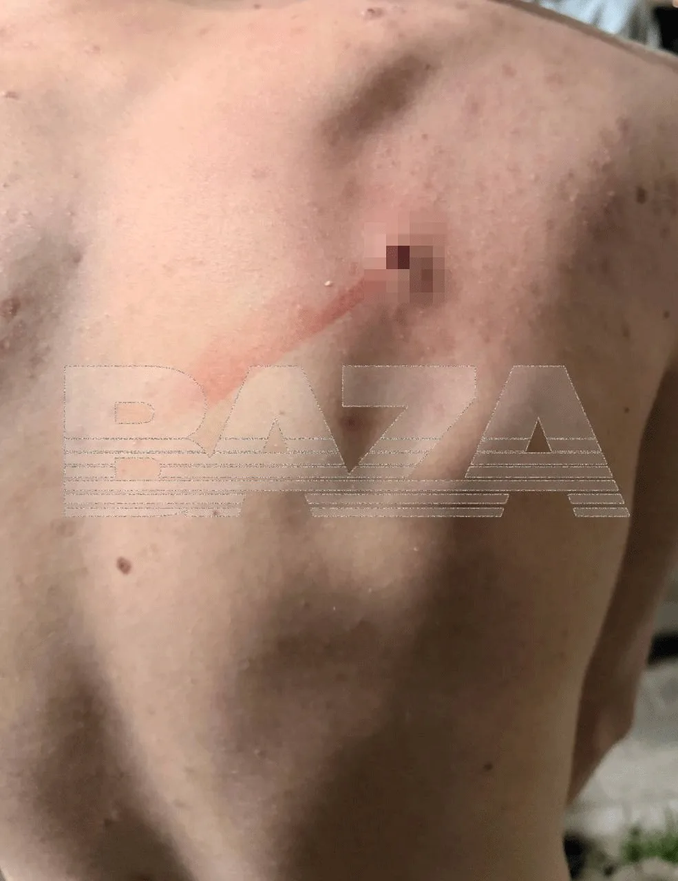 В Люберцах неизвестный из окна расстрелял из пневматического ружья группу подростков во дворе.  По д
