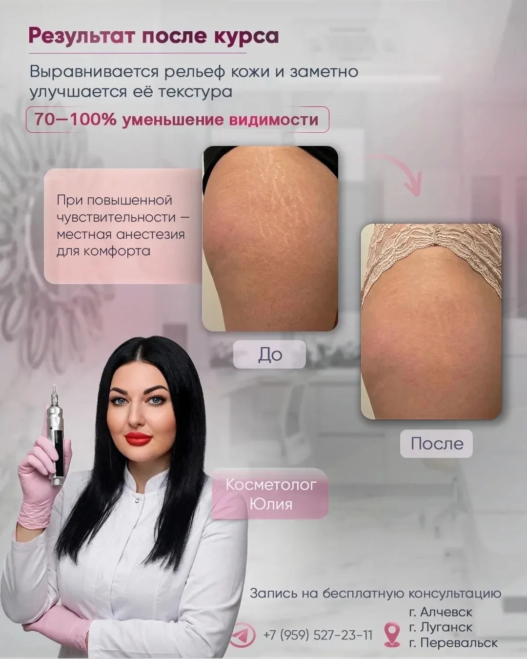 https://vk.ru/im/channels/-231028095?cmid=238
