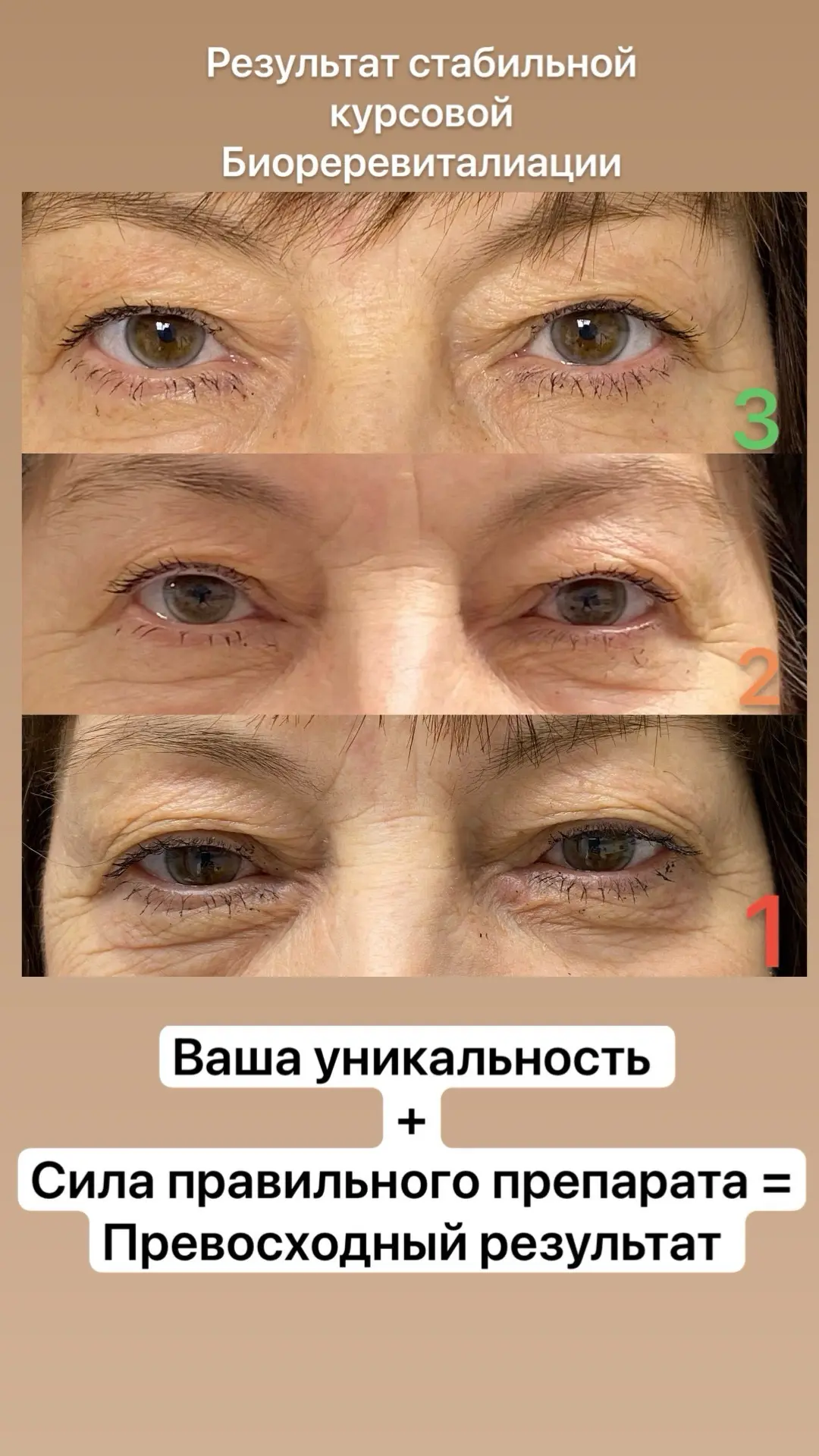 На фото ☝️результат комплексной систематической процедуры + грамотный подбор препарата. 

#уходзакож