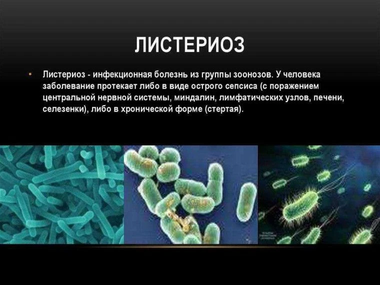 Профилактика листериоза
Листериоз – это инфекционное заболевание людей и животных, вызываемое патоге