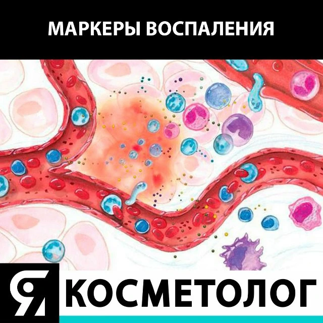 💥Воспаление представляет собой защитную реакцию васкуляризированных тканей против местного агрессив