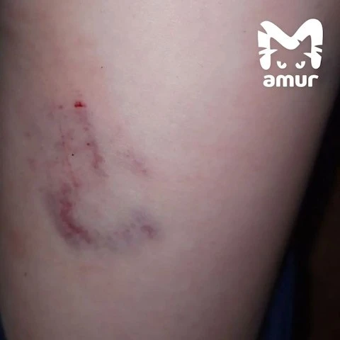 В Хабаровске агрессивная собака нападает на детей — родители боятся отпускать их на улицу