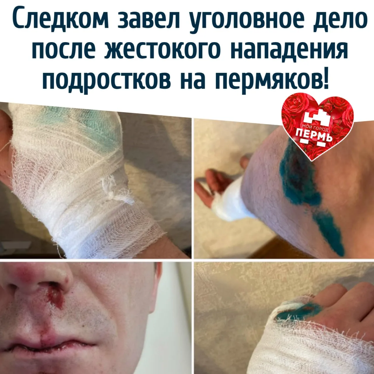 Следком завел уголовное дело после жестокого нападения подростков на пермяков! Агрессоров ищут.
⠀
На