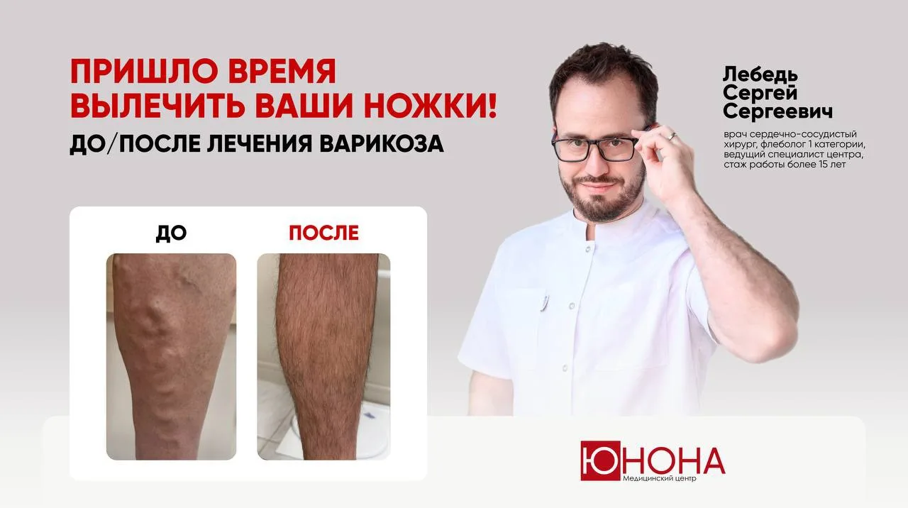 ДО/ПОСЛЕ: