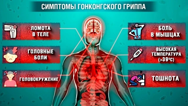 Вирусолог рассказала, как определить первые симптомы гонконгского гриппа.
