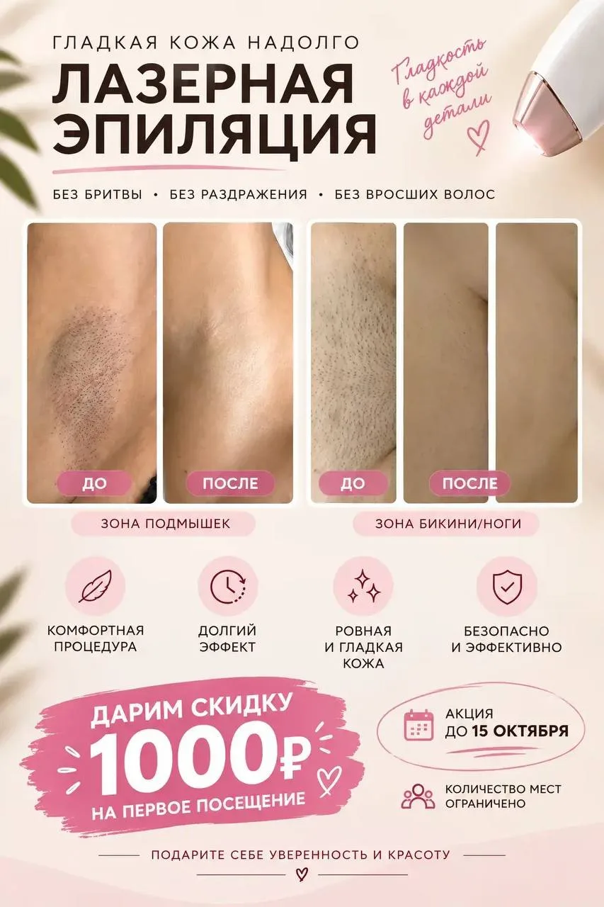 Студия эстетики «ЛОТОС» приглашает на процедуры лазерной эпиляции.