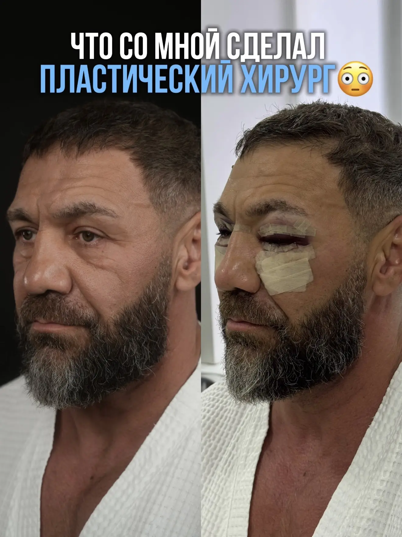 ЧТО СО МНОЙ СДЕЛАЛ ПЛАСТИЧЕСКИЙ ХИРУРГ?