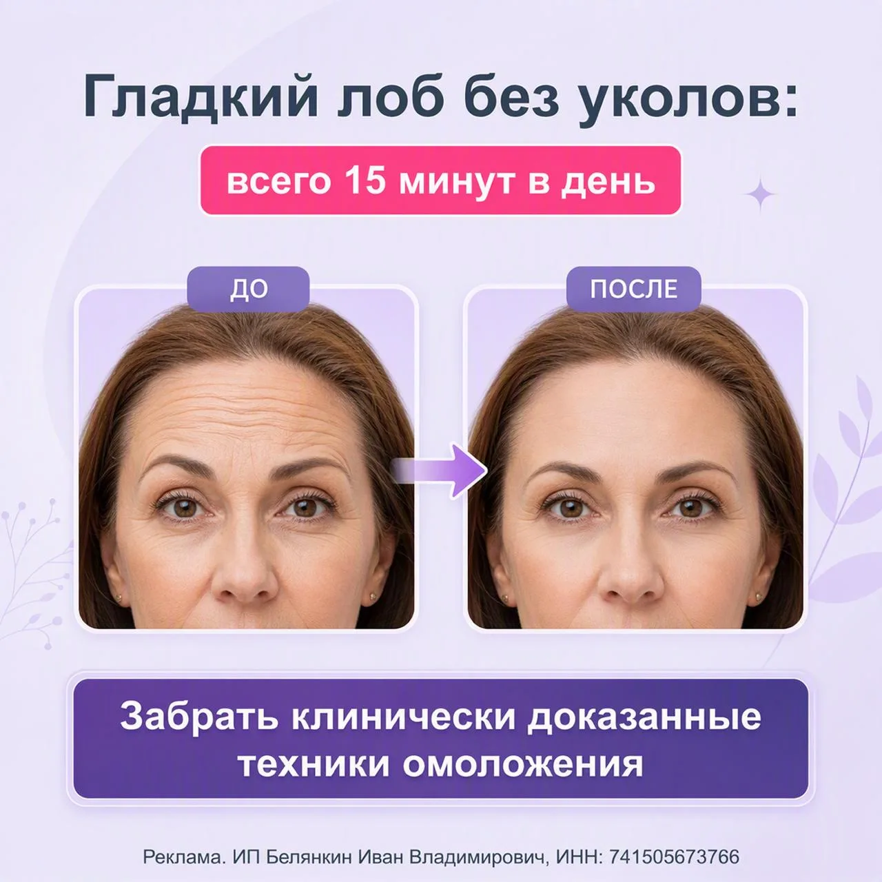 🧴 Почему кремы не разглаживают морщины на лбу, даже если стоят целое состояние?
