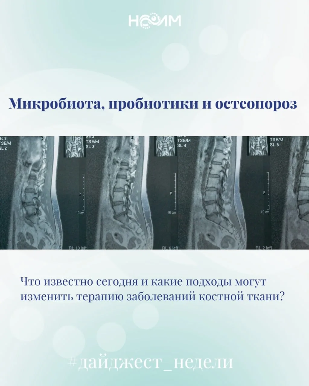 Кишечная микробиота участвует в регуляции костного обмена через микробные метаболиты, а...