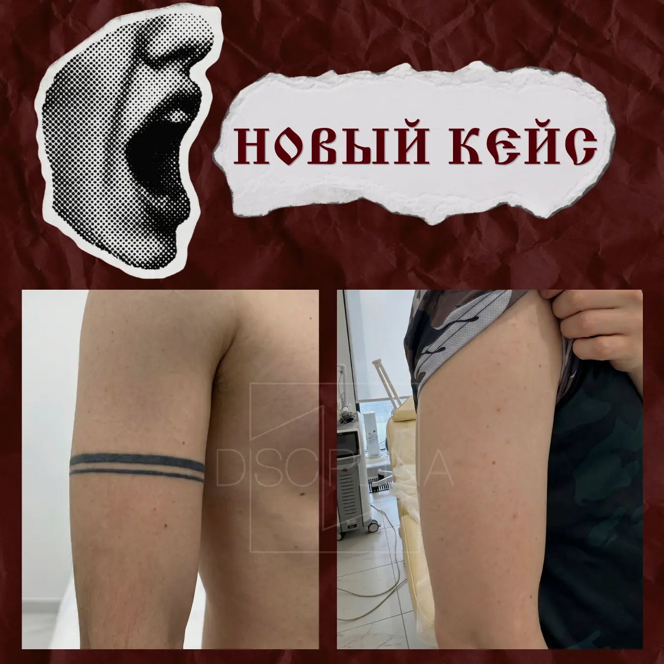 Новый кейс 🤩