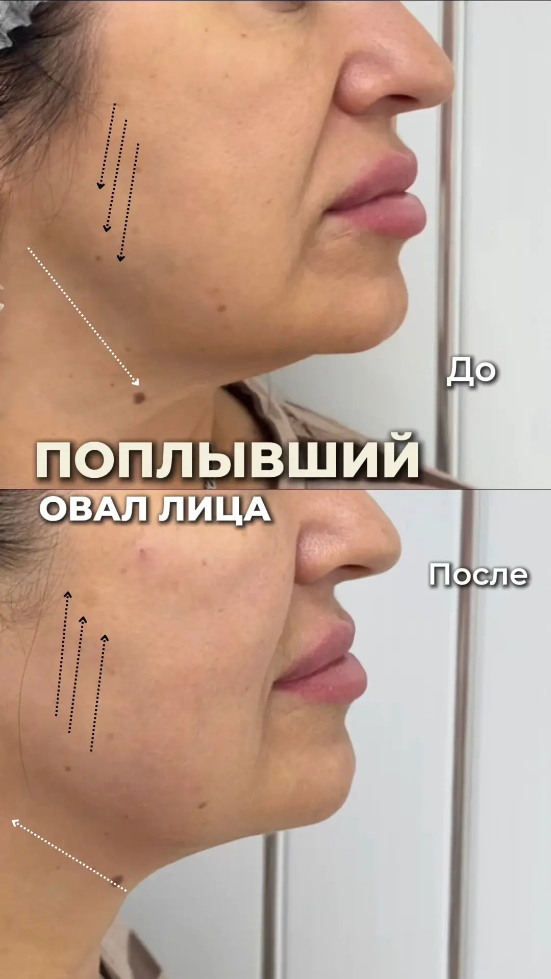БРЫЛИ ВЫДАЮТ ВОЗРАСТ?