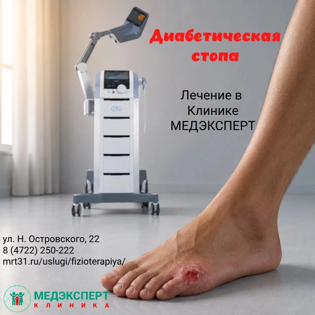 Консультация невролога по спеццене.