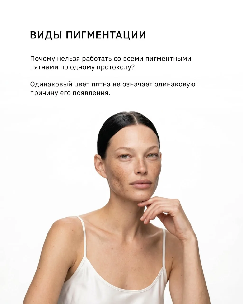Пигментное пятно — это диагноз или симптом?