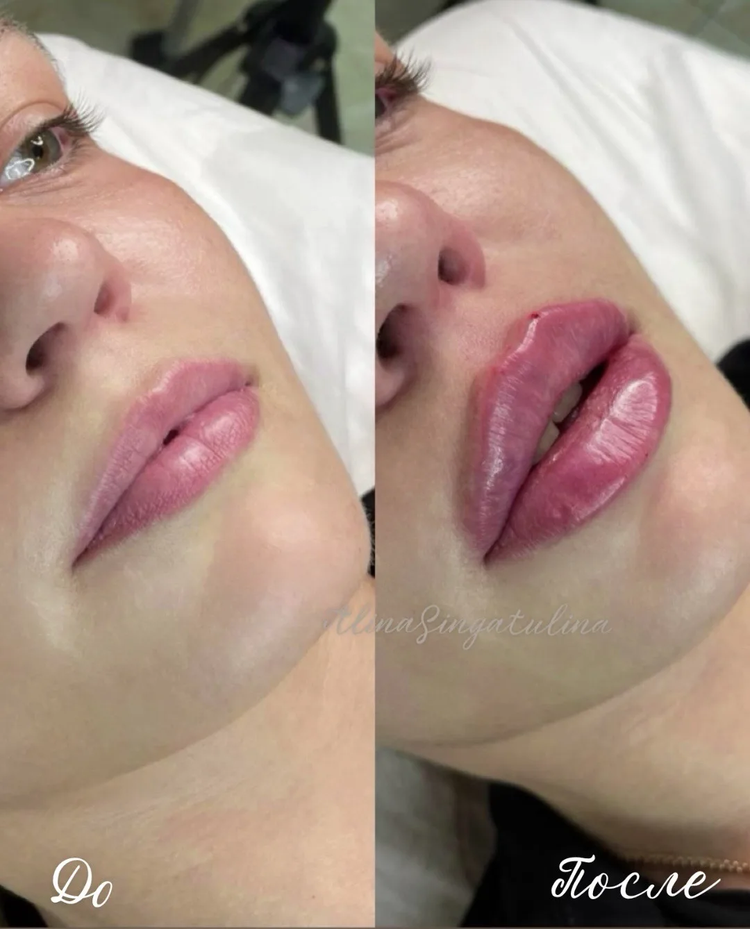 Губы - 👄
