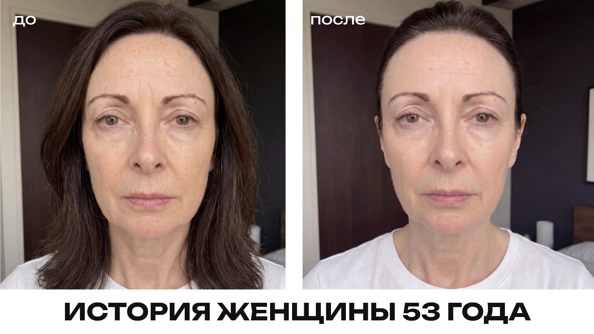 Мне 53 года. Что произошло за месяц домашнего ухода 😮