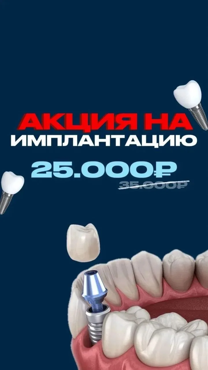 ❗️СЕЗОН ВЫГОДНЫХ УЛЫБОК В АРТ ДЕНТ❗️