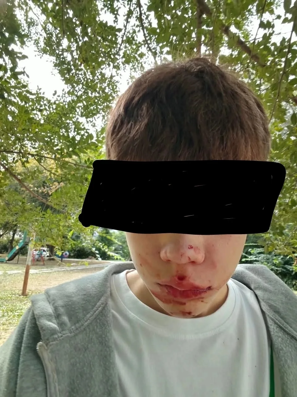 Первого сентября в торжественный день для деток, мой сын был жестоко избит своими однок...