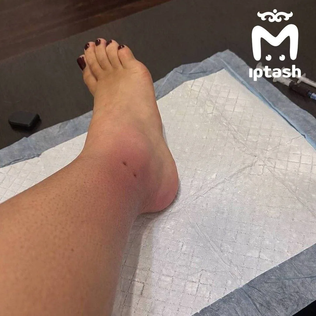 ❗️Гадюка укусила велосипедистку в Иннополисе на Спортивной.