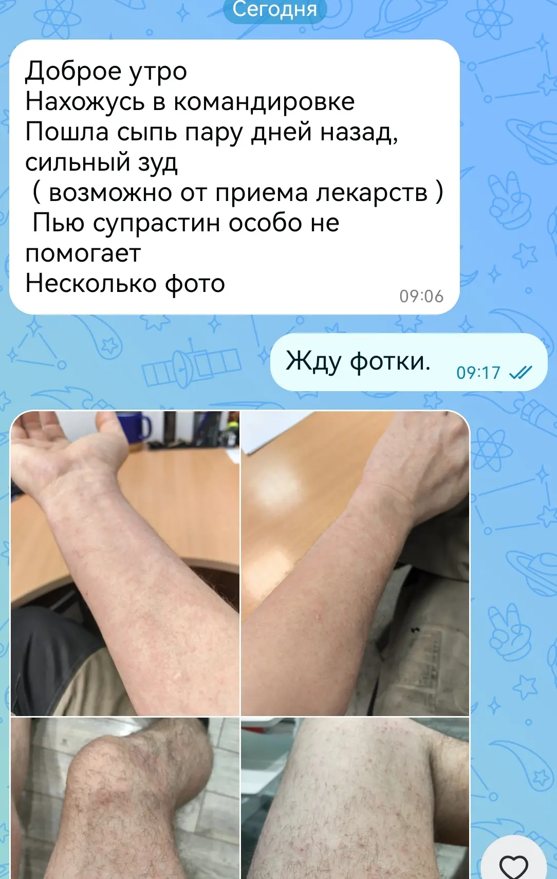 🤯Срочно!!! У моего пациента появилась аллергическая реакция после начала приема лекарств. Что делат