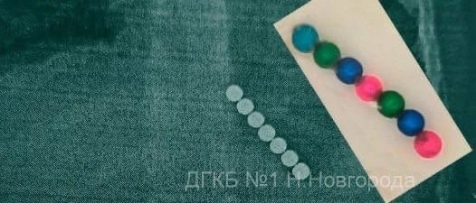 Семь магнитных шариков вытащили нижегородские врачи из желудка ребёнка.  Двухлетний малыш проглотил 