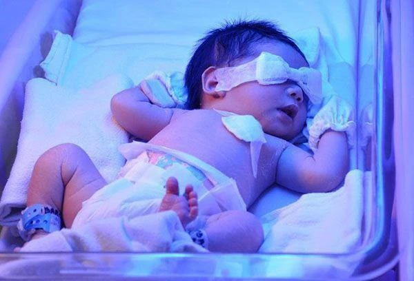 🐣 Неонатальная желтуха считается одной из самых распространенных проблем в период новорожденности. 