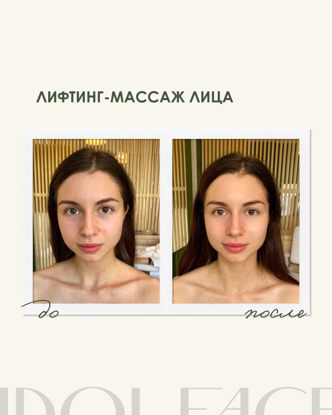 Видимый результат за один сеанс✨

Наглядный пример того, как работает лифтинг-массаж лица. Без боли,
