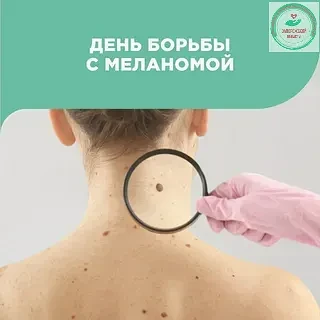 Всемирный день борьбы с меланомой