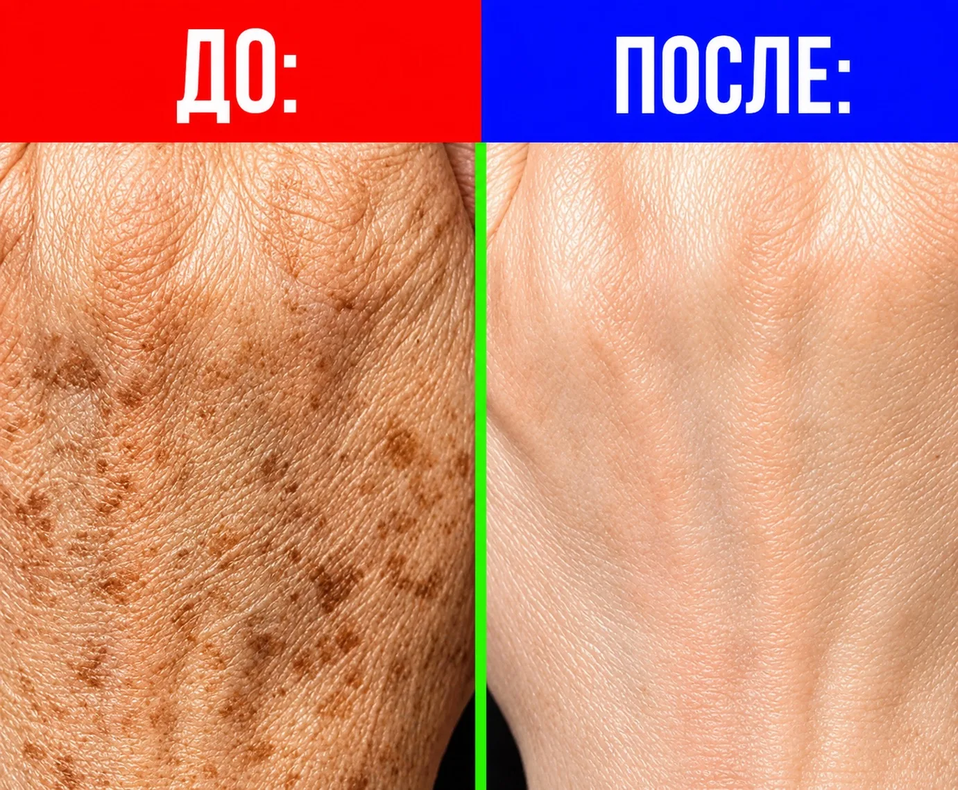 🙈 Я СТЕСНЯЛАСЬ ВЫХОДИТЬ НА УЛИЦУ, ХОДИЛА В ПЕРЧАТКАХ ДАЖЕ ЛЕТОМ