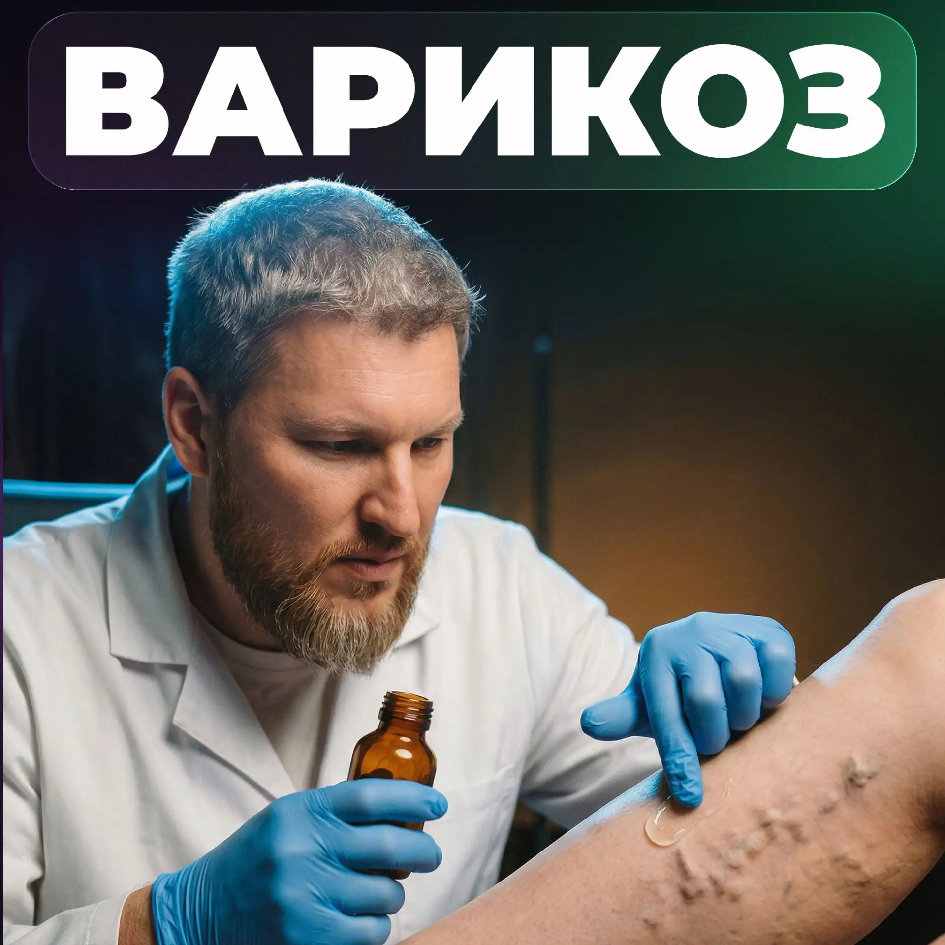 Что нужно знать про варикоз и сосудистые звездочки на ногах: