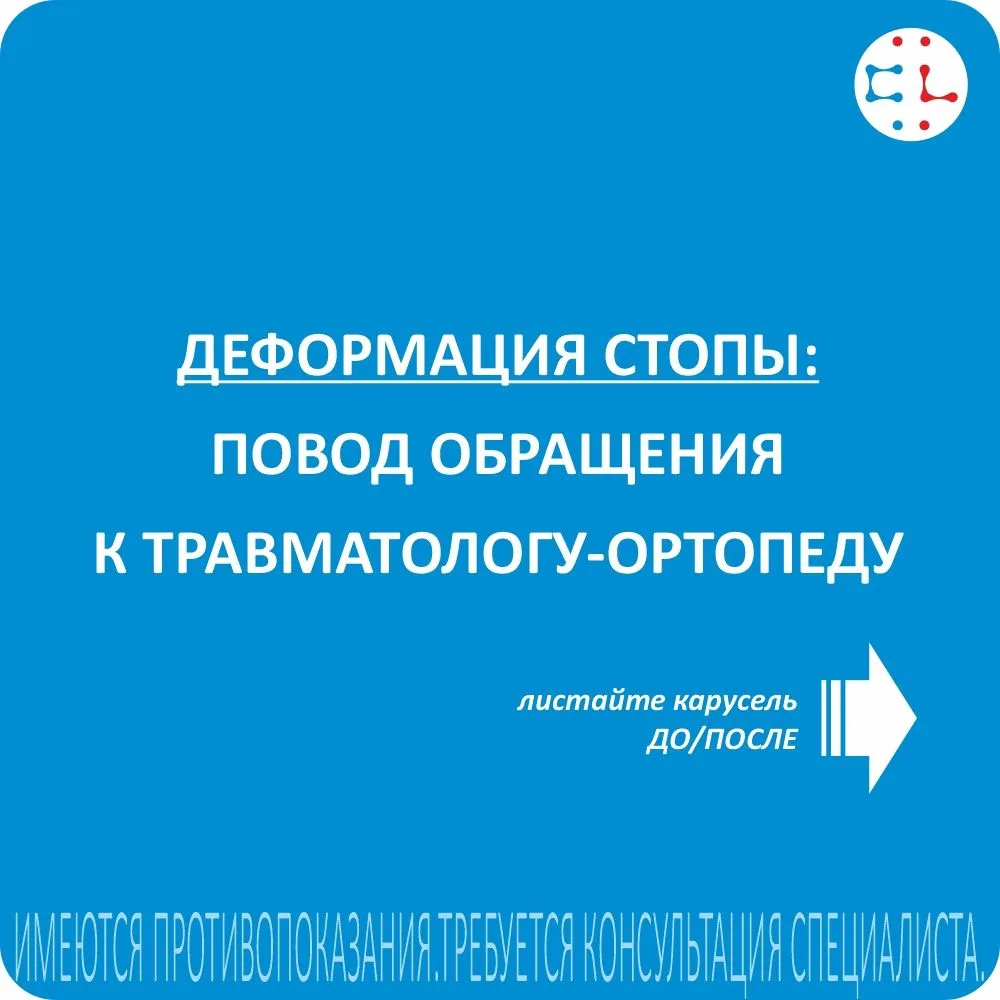 ДЕФОРМАЦИЯ СТОПЫ: