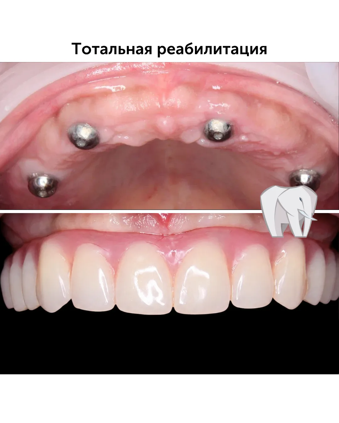 Есть решения, которые меняют не просто внешность — они возвращают уверенность, лёгкость, желание фот