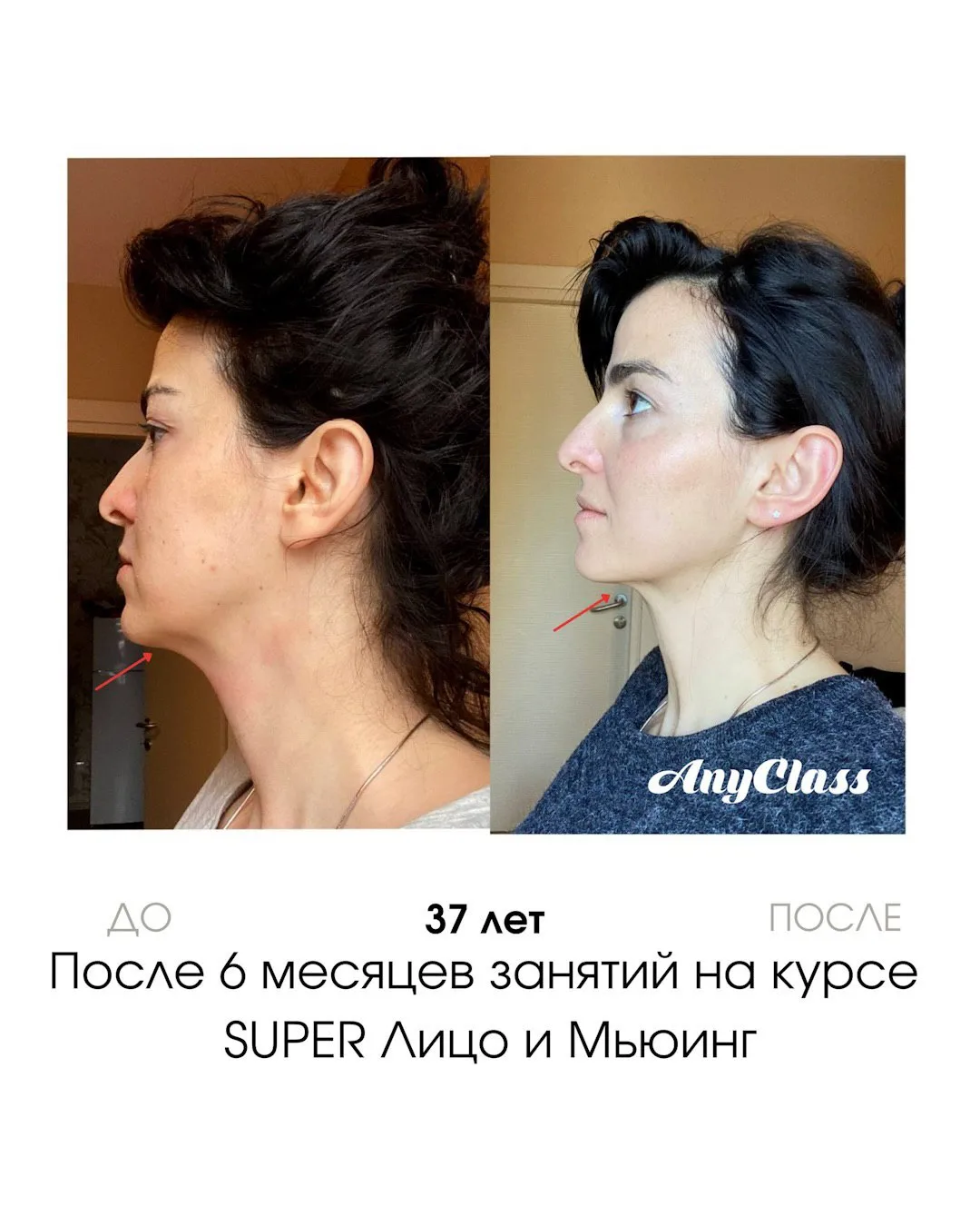 Изображение 2 к публикации «Гимнастика для лица»