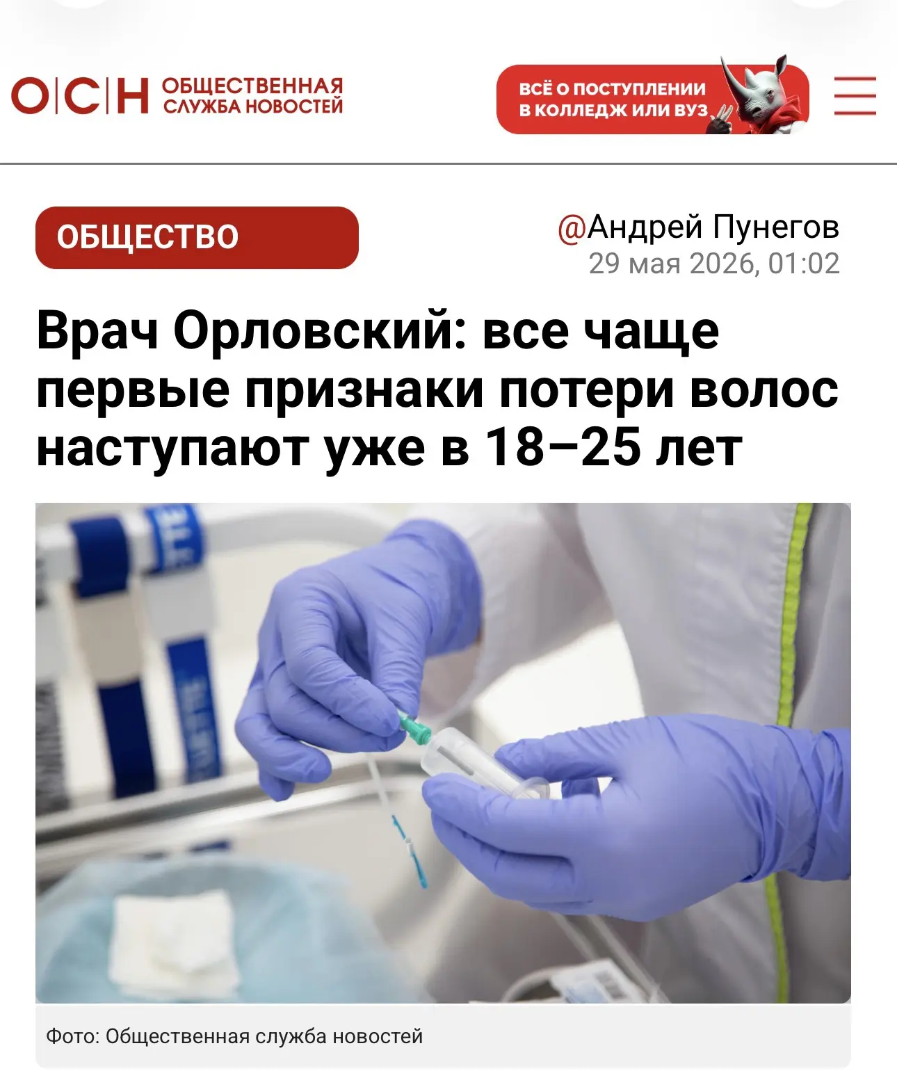 Лысеть в 20 лет? Раньше это было редкостью. Теперь — тенденция.