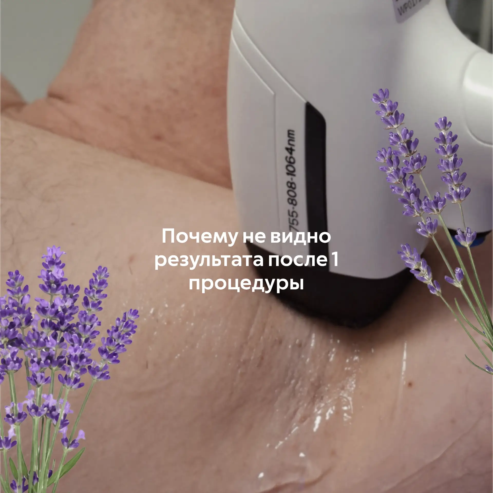 Это нормальный вопрос

Волосы растут в фазах
Лазер работает только с активными волосами

Поэтому нуж